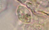 Protists