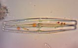 Diatom